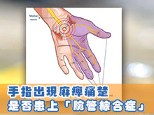 手指出現麻痺痛楚 是否患上「腕管綜合症」
