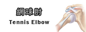 網球肘Tennis Elbow
