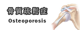 骨質疏鬆症Osteoporosis