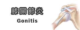 膝關節炎Gonitis
