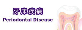 牙床疾病Periodontal Disease
