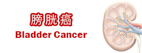 膀胱癌Bladder Cancer