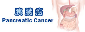 胰臟癌Pancreatic Cancer