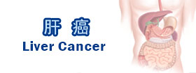肝癌Liver Cancer