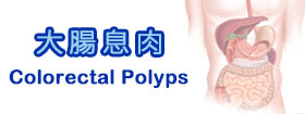 大腸息肉Colorectal Polyps