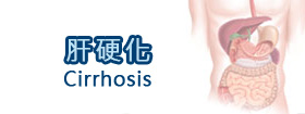 肝硬化Cirrhosis