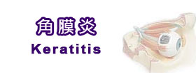 角膜炎Keratitis