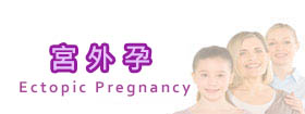 宮外孕Ectopic Pregnancy