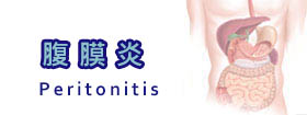 腹膜炎Peritonitis
