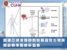 中大醫學院創建亞洲首個膀胱癌類器官生物庫 開啟精準醫療新篇章