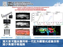 港大首次臨床應用新一代紅外線螢光成像技術，減少食道手術風險